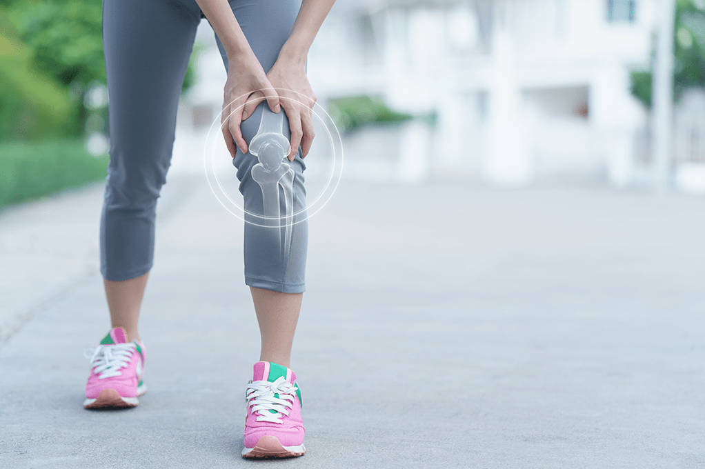 Understanding the Iliotibial Band Friction Syndrome